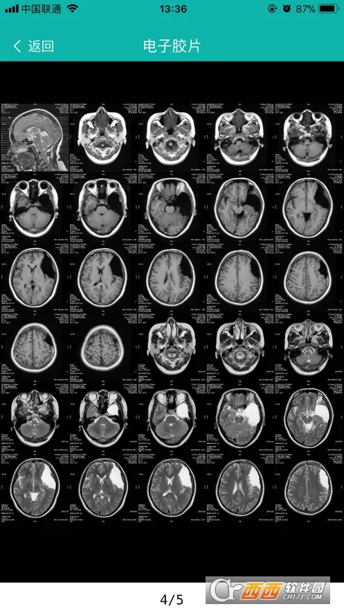 ΢Ӱҽ��(ҽ��Ӱ�����)